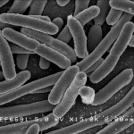 e coli bacteria